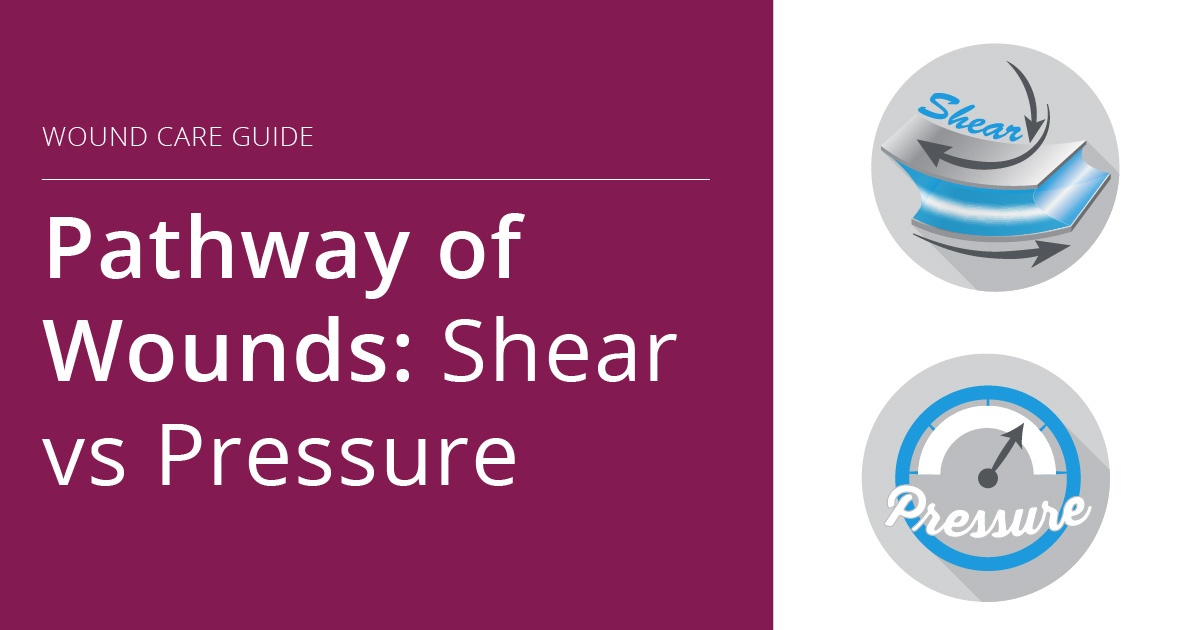 Pathway of Wounds Shear vs Pressure